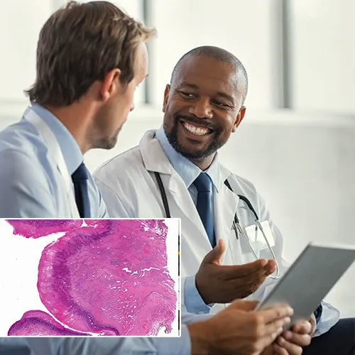 Why Choose  AtlantiCare Physician Group Surgical Associates 
for Your Penile Implant?