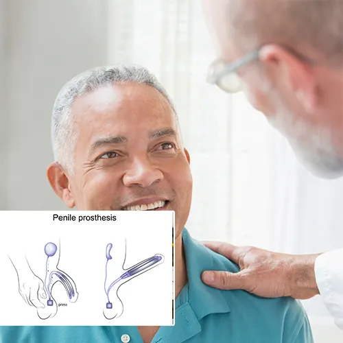 What Is Penile Implant Surgery?